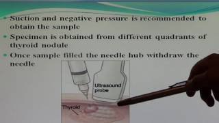 Fine Needle Aspiration Cytology by Dr Danish [upl. by Boot]