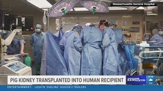 First genetically modified pig kidney transplanted into human recipient [upl. by Animas]