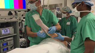 Basic Shoulder Arthroscopy Lateral Decubitus Patient Positioning [upl. by Dawes9]