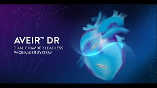 AVEIR DR™ Dual Chamber Leadless Pacemaker System 3D Implantation Simulation [upl. by Prue357]