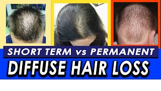 Permanent vs Temporary Diffuse Hair Loss and Telogen Effluvium How to differentiate [upl. by Wellington426]