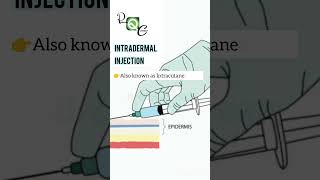 INTRADERMAL INJECTION pharmacy nursing neet science biology [upl. by Tan534]