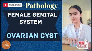 Ovarian Cyst PATHOLOGY Explained [upl. by Nwatna]