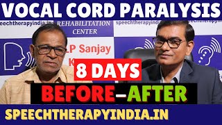 BeforeAfter  Unilateral Vocal Cord Paralysis Phonatory Gap  8 Days Voice Therapy  AIIMS Alumnus [upl. by Sardella537]