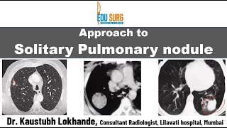 Solitary pulmonary nodule  When to suspect lung cancer  characteristics and follow up  Approach [upl. by Cattier505]