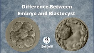 What is the difference between an Embryo and Blastocyst  IVF Specialist [upl. by Nwahsid622]