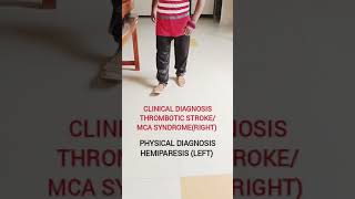 Physical diagnosisHemiparesis Leftcvastrokeneurologyphysiotherapylearningmriscanrehabumn [upl. by Grail]