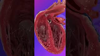 The Congenital Heart Defect healthcareeducation medicalanimation 3danimation [upl. by Pall]