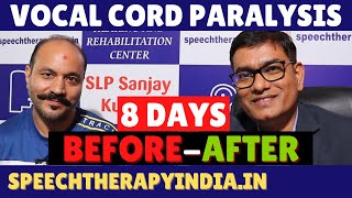 BeforeAfter  Unilateral Vocal Cord Paralysis Phonatory Gap  8 Days Treatment  slpsanjaykumar [upl. by Llij]