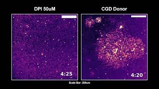 Disorganized Calcium waves in patient neutrophils during swarming [upl. by Goth]