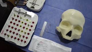 Cómo realizar la instalación quirúrgica de los Implantes Cigomáticos [upl. by Allerym942]