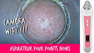 ASPIRATEUR POINTS NOIRS ET COMÉDONS AVEC UNE CAMÉRA HD [upl. by Kali]