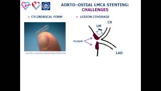 PCI IN LM PART 3 OSTIAL STENOSIS english [upl. by Amorete826]