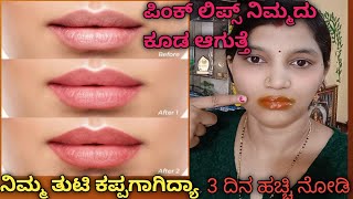 How I get rid of Pigmented Lips 👄 REAL LIP CARE ROUTINE changes my lip colour [upl. by Ailemak]