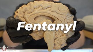 Why Fentanyl Is So Incredibly Dangerous [upl. by Tevis]