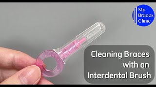 Cleaning Braces with an Interdental Brush [upl. by Aitas357]