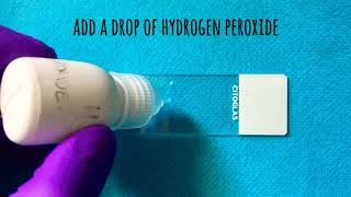 Catalase and Oxidase Test  clinical microbiology essentials [upl. by Htezil]