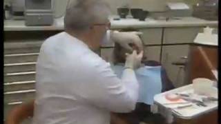 Complete Denture Overview [upl. by Gayla]