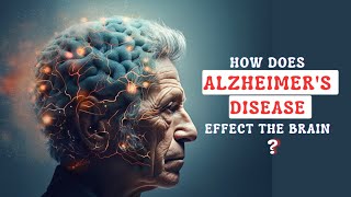 How Does The Alzheimers Disease Affect the Brain [upl. by Enutrof]