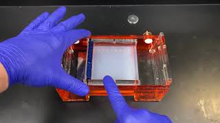 Agarose Gel Electrophoresis [upl. by Ardaed77]