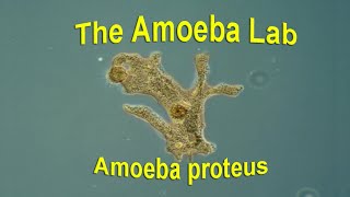 Amoeba Proteus – Time Lapse amp Real time by the Amoeba Lab [upl. by Chaunce881]