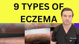 All 9 types of Eczema explained by Dr Martin Smith [upl. by Kliment716]