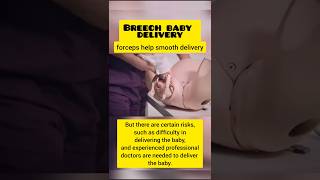 Breech Baby Delivery 🤰  breech baby medicalstudent satisfying medical shorts [upl. by Zoltai486]