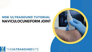 Naviculocuneiform joint NCJ [upl. by Eirojam529]