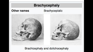 DolichocephalicBasics of AnatomyAnthropology Optional [upl. by Eiffe763]