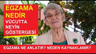 EGZAMA NE ANLATIR NEDEN KAYNAKLANIR quotEGZAMADAN BİR TÜRLÜ KURTULAMIYORUMquot DİYENLER MUTLAKA İZLEYİN [upl. by Cathrine]