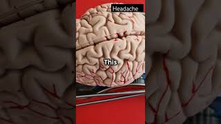 Ancient Brain Surgery Trepanation Explainedhealth science facts history surgun [upl. by Alyahsat334]