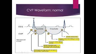 Haemodynamic Monitoring part II [upl. by Juanne]