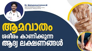 ആമവാതം ശരീരം കാണിക്കുന്ന ആദ്യ ലക്ഷണങ്ങൾ  Rheumatoid Arthritis Malayalam  Dr Muhammed Aslam [upl. by Meill]