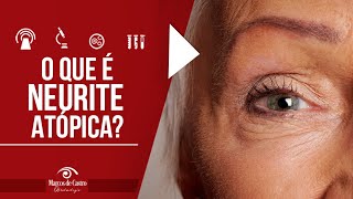 O que é a Neurite Óptica  Dr Marcos de Castro Oftalmologia [upl. by Harmaning]