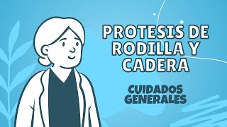 Lo que debes saber sobre los cuidados de las heridas en prótesis de cadera y rodilla ortopedia [upl. by Odicalp960]