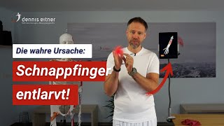 Wie kommt es zum Schnappfinger Verstehe jetzt die wahre Ursache ✅ [upl. by Names]