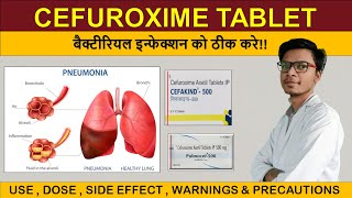 cefuroxime axetil 500 mg tablet uses in hindi  cefakind 500  pulmocef 500 [upl. by Robenia117]