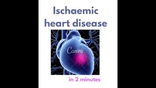 Ischemic Heart Disease in under 2 mins [upl. by Ezeerb]