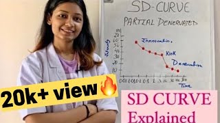 SD Curve in electrotherapy  strength duration curve  physiotherapy  in hindi [upl. by Georgena118]