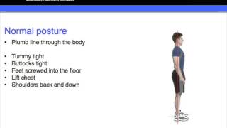 Lordosis kyphosis amp correct posture part 3 [upl. by Sucirdor]