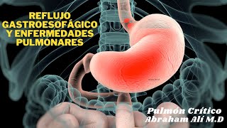 Reflujo Gastroesofágico y Enfermedades Pulmonares [upl. by Lola]