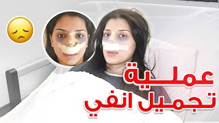 عملت عملية تجميل انفي بتركيا 👃🏻🏥 [upl. by Htaek]