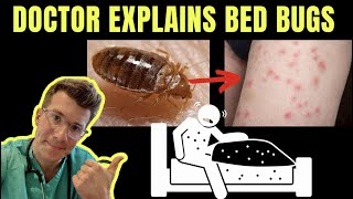 Doctor explains BED BUGS  including SYMPTOMS TREATMENT AND PREVENTION  PHOTOS [upl. by Anirdua]