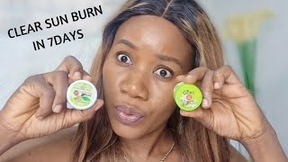 7 DAYS FAST ACTION SUNBURN amp SPOTS CREAM  WHITENING FACE CREAM  HOW TO MAKE WHITENING FACE CREAM [upl. by Akirdnuhs]