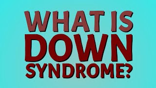 What is Down Syndrome Down syndrome trisomy 21 [upl. by Centonze]