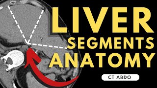 Liver Segments on CT scan  Radiology anatomy part 1 prep  Segmental Liver Anatomy CT [upl. by Eihctir]