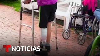 Un hombre crea prótesis de piernas con chatarra en Colombia  Noticias Telemundo [upl. by Yllus]