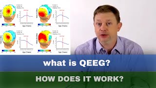 QEEG amp sLORETA Brain Mapping Basics Explained [upl. by Elleyoj231]