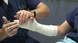 Splint Workshop 3  Ulnar Gutter Splint [upl. by Ellersick]