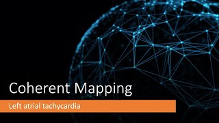 Coherent Mapping left atrial tachycardia after previous AF ablation [upl. by Ytnom]
